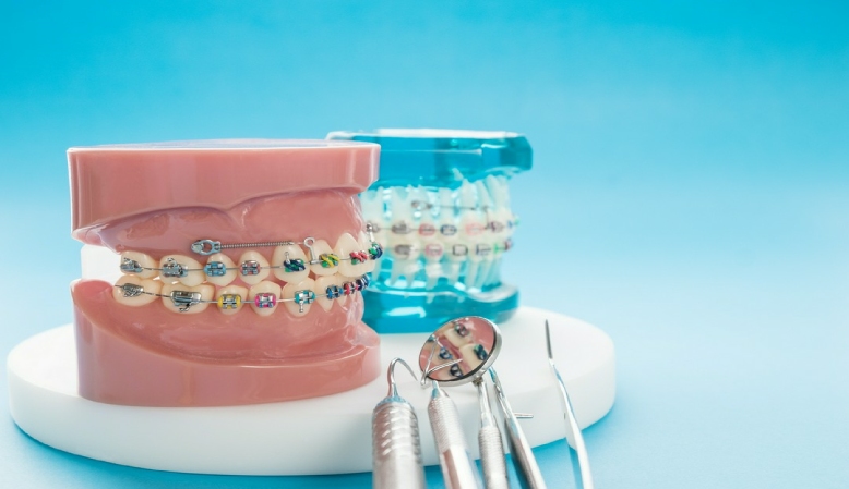 koszt leczenia ortodontycznego